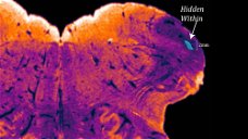 Copertina di Scoperta nuova area del cervello, il 'Nucleo Endorestiforme'