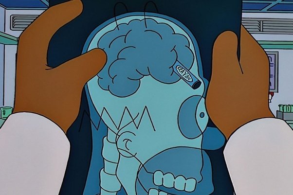 La radiografia con il pastello nel cervello di Homer