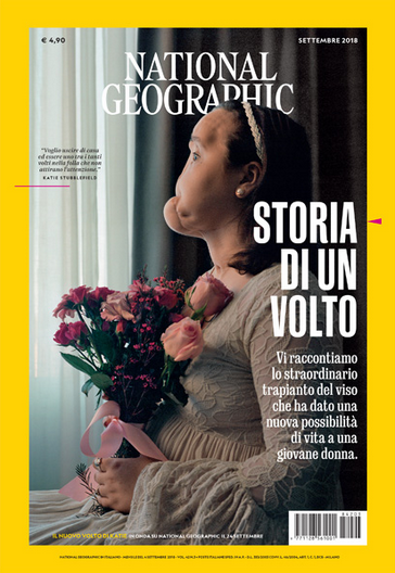 National Geographic magazine ha raccontato la storia di Katie