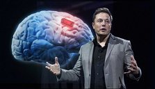 Copertina di Elon Musk: a breve aggiornamenti sul cervello ibrido uomo-macchina
